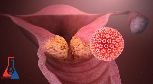 HPV