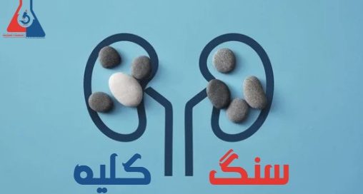 سنگ کلیه