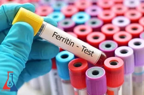 فریتین خون
