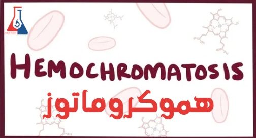 هموکروماتوز