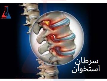 سرطان استخوان