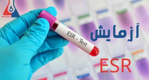 آزمایش ESR
