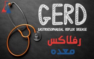 رفلاکس معده