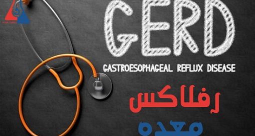 رفلاکس معده