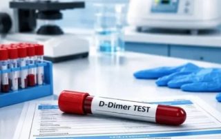 d-dimer-test