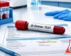 آزمایش D-Dimer چیست؟ تفسیر نتایج، علت بالا بودن و آمادگی قبل از آزمایش
